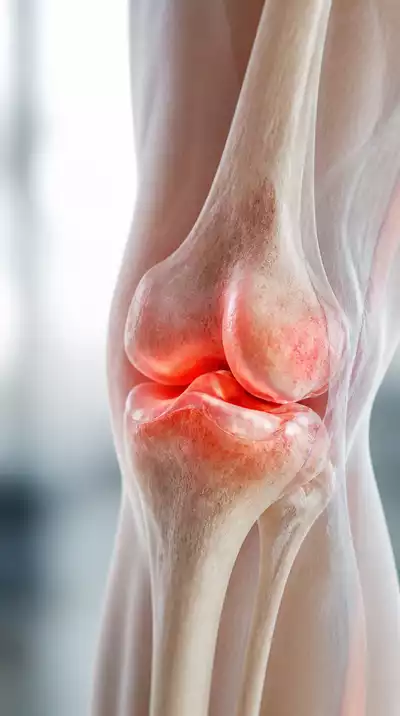 Understanding inflammation